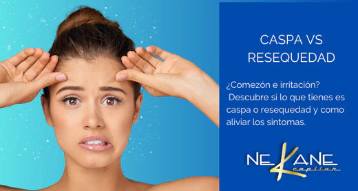 Caspa vs Resequedad